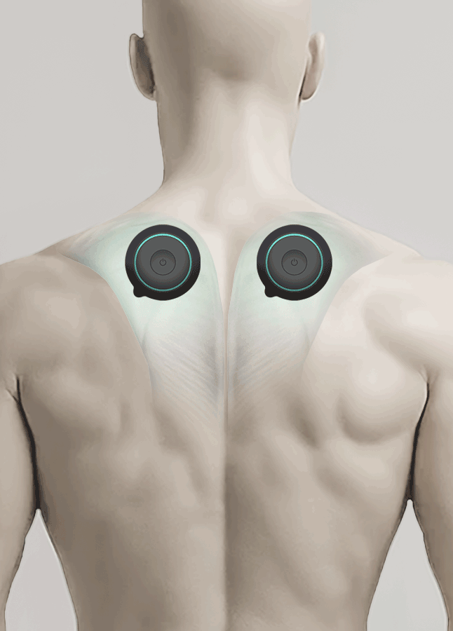 Chirp Halo Wireless TENS and EMS Pain Relief Therapy Unit
