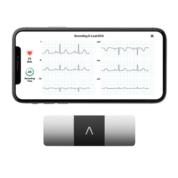 Alivecor KardiaMobile 6L Electrocardiograph EKG